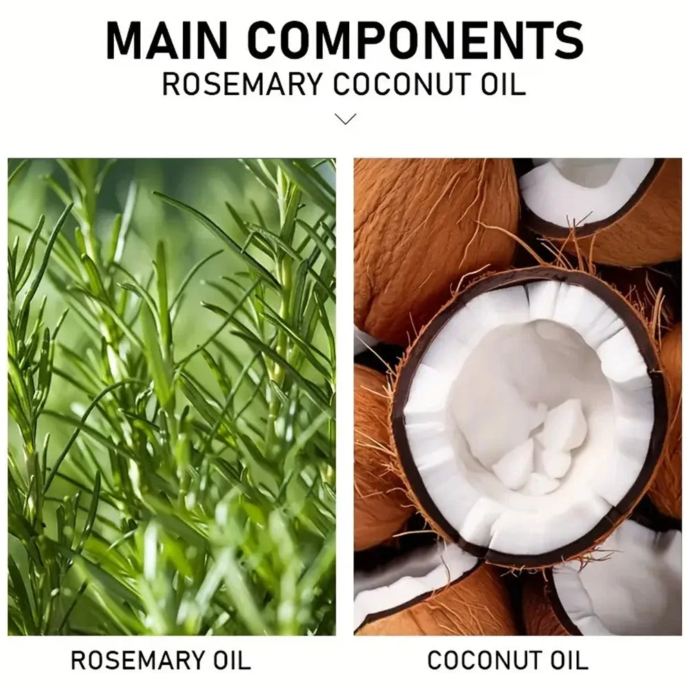 Rosemary Hair Oil – Scalp Treatment for Hair Growth