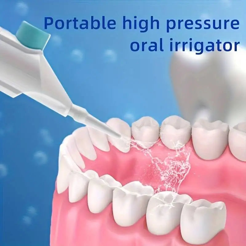 Portable Oral Irrigator – Manual High-Pressure Water Flosser