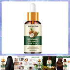 Rosemary Hair Oil – Scalp Treatment for Hair Growth