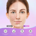 Star-Shape Acne Patches – Gentle Blemish Concealer Dots